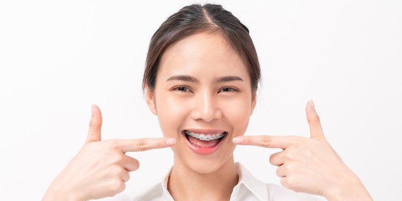 牙齒矯正必睇指南：3大好處、最佳治療策略與常見疑問一次搞懂