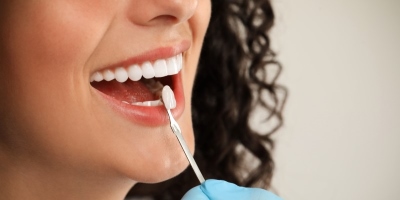 牙齒美白 補牙就靠「它」牙貼片讓你輕鬆展現亮白笑容