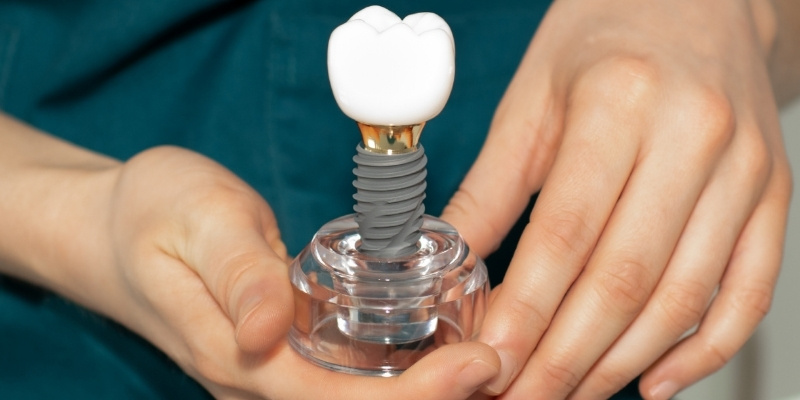 種牙費用怎麼算?全面解構種牙流程與養護,重拾自信笑容! 種牙費用怎麼算?全面解構種牙流程與養護,重拾自信笑容!